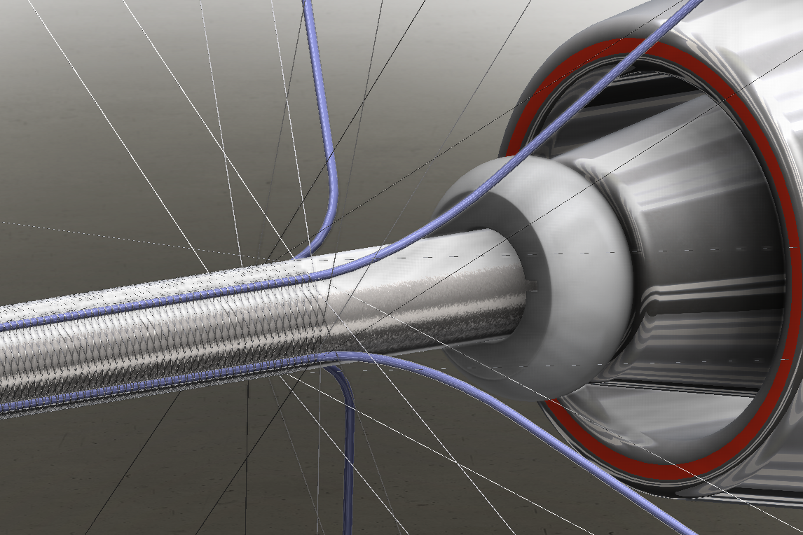Catheter being braided